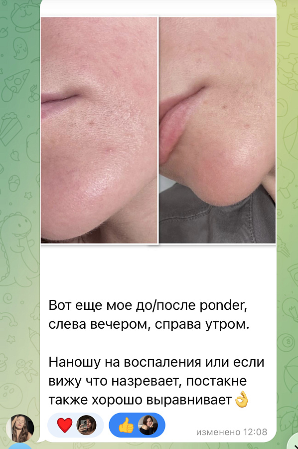 Фото отзывы